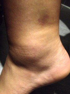 ankle